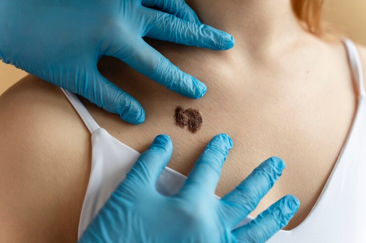 10 Skin Cancer Prevention Tips from a Medical Specialist