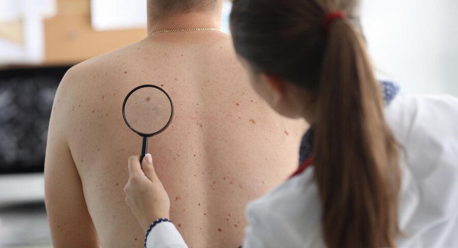 Signs You Should Visit a Skin Cancer Specialist: A Comprehensive Guide