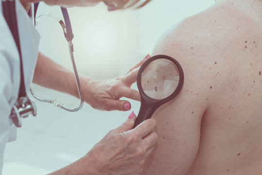 Skin Cancer Myths You Should Stop Believing